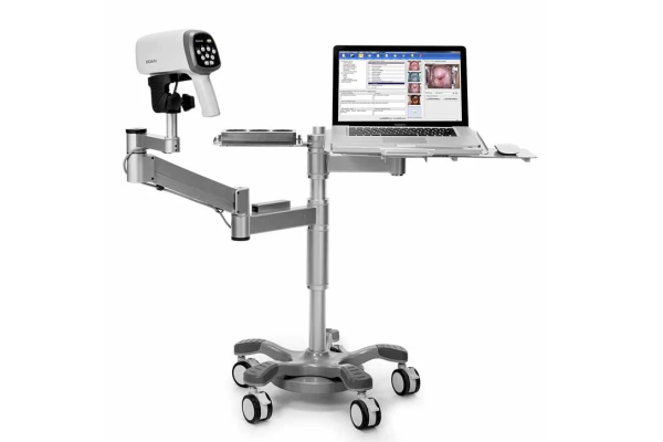 colposcope